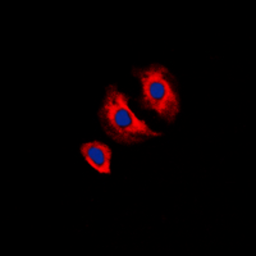 Anti-VEGF Receptor 2 (phospho Tyr1175) antibody used in Immunocytochemistry/ Immunofluorescence (ICC/IF). GTX32403