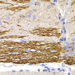 Anti-NF-L antibody used in IHC (Paraffin sections) (IHC-P). GTX32419