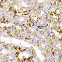 Anti-NF-L antibody used in IHC (Paraffin sections) (IHC-P). GTX32419