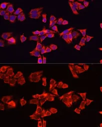 Anti-Albumin antibody used in Immunocytochemistry/ Immunofluorescence (ICC/IF). GTX32430