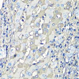 Anti-Albumin antibody used in IHC (Paraffin sections) (IHC-P). GTX32430