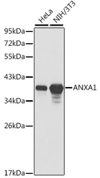 Anti-Annexin A1 antibody used in Western Blot (WB). GTX32444
