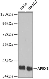 Anti-APE1 antibody used in Western Blot (WB). GTX32451