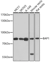 Anti-BAP1 antibody used in Western Blot (WB). GTX32464