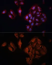 Anti-BAP1 antibody used in Immunocytochemistry/ Immunofluorescence (ICC/IF). GTX32464