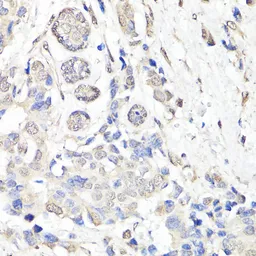 Anti-BAP1 antibody used in IHC (Paraffin sections) (IHC-P). GTX32464