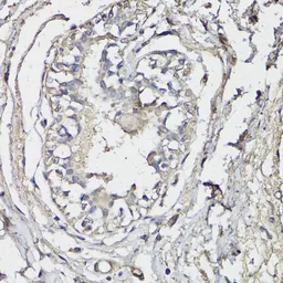 Anti-BAP1 antibody used in IHC (Paraffin sections) (IHC-P). GTX32464
