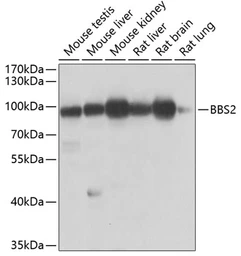 Anti-BBS2 antibody used in Western Blot (WB). GTX32466