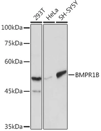 Anti-BMPR1B antibody used in Western Blot (WB). GTX32474