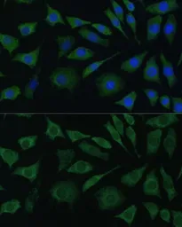 Anti-BMPR1B antibody used in Immunocytochemistry/ Immunofluorescence (ICC/IF). GTX32474