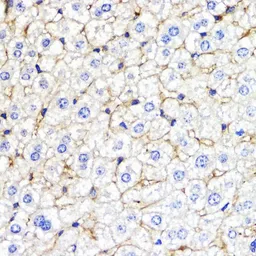 Anti-BMPR1B antibody used in IHC (Paraffin sections) (IHC-P). GTX32474