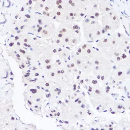 Anti-BRG1 antibody used in Immunocytochemistry/ Immunofluorescence (ICC/IF). GTX32478