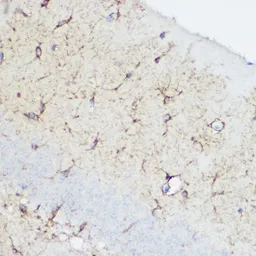 Anti-Calpain 1 antibody used in IHC (Paraffin sections) (IHC-P). GTX32486