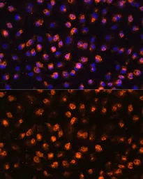 Anti-CD11b antibody used in Immunocytochemistry/ Immunofluorescence (ICC/IF). GTX32495
