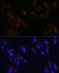 Anti-CD133 antibody used in Immunoprecipitation (IP). GTX32496