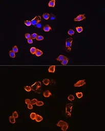 Anti-CD14 antibody used in Immunocytochemistry/ Immunofluorescence (ICC/IF). GTX32497