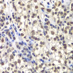 Anti-CENPC antibody used in IHC (Paraffin sections) (IHC-P). GTX32516
