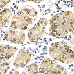 Anti-CHIT1 antibody used in IHC (Paraffin sections) (IHC-P). GTX32519