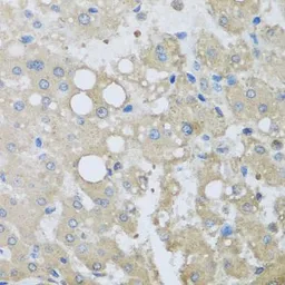 Anti-CHMP1B antibody used in IHC (Paraffin sections) (IHC-P). GTX32520