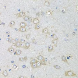 Anti-CHMP1B antibody used in IHC (Paraffin sections) (IHC-P). GTX32520