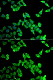 Anti-Cip4 antibody used in Immunocytochemistry/ Immunofluorescence (ICC/IF). GTX32523