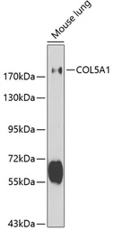 Anti-COL5A1 antibody used in Western Blot (WB). GTX32530