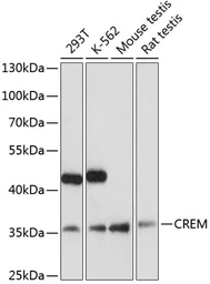 Anti-CREM antibody used in Western Blot (WB). GTX32538