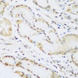 Anti-Cyclin D2 antibody used in IHC (Paraffin sections) (IHC-P). GTX32545