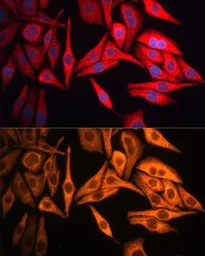 Anti-Cytokeratin 8 antibody used in Immunocytochemistry/ Immunofluorescence (ICC/IF). GTX32549