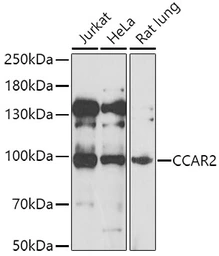 Anti-DBC1 antibody used in Western Blot (WB). GTX32552
