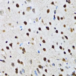 Anti-DBC1 antibody used in IHC (Paraffin sections) (IHC-P). GTX32552