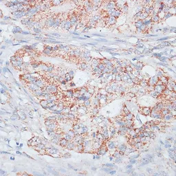 Anti-Desmoplakin antibody used in IHC (Paraffin sections) (IHC-P). GTX32557