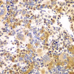 Anti-DTX2 antibody used in IHC (Paraffin sections) (IHC-P). GTX32566
