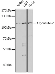 Anti-EIF2C2 antibody used in Western Blot (WB). GTX32577