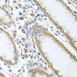Anti-eIF4E antibody used in IHC (Paraffin sections) (IHC-P). GTX32580