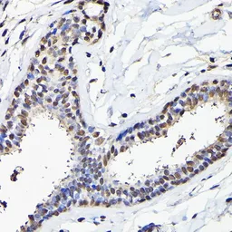 Anti-EIF5A antibody used in IHC (Paraffin sections) (IHC-P). GTX32581