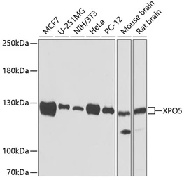 Anti-Exportin 5 antibody used in Western Blot (WB). GTX32594