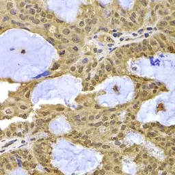Anti-Exportin 5 antibody used in IHC (Paraffin sections) (IHC-P). GTX32594