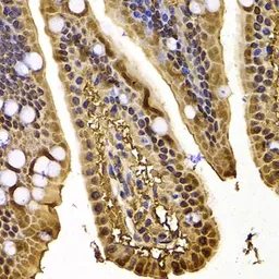 Anti-Exportin 5 antibody used in IHC (Paraffin sections) (IHC-P). GTX32594