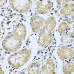 Anti-FBXL5 antibody used in IHC (Paraffin sections) (IHC-P). GTX32599