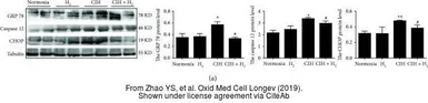 Anti-GADD153 antibody used in Western Blot (WB). GTX32616