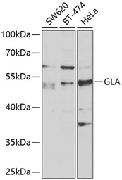 Anti-Galactosidase alpha antibody used in Western Blot (WB). GTX32617