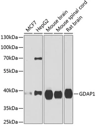 Anti-GDAP1 antibody used in Western Blot (WB). GTX32623