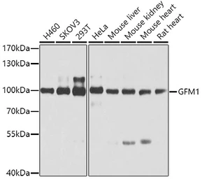 Anti-GFM1 antibody used in Western Blot (WB). GTX32625