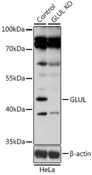 Anti-Glutamine synthetase antibody used in Western Blot (WB). GTX32627