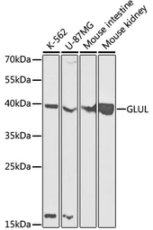 Anti-Glutamine synthetase antibody used in Western Blot (WB). GTX32627