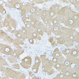 Anti-Glutamine synthetase antibody used in IHC (Paraffin sections) (IHC-P). GTX32627