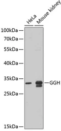Anti-Glutamyl hydrolase gamma antibody used in Western Blot (WB). GTX32628