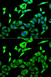 Anti-HADHA antibody used in Immunocytochemistry/ Immunofluorescence (ICC/IF). GTX32642