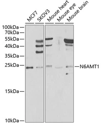 Anti-HEMK2 antibody used in Western Blot (WB). GTX32649